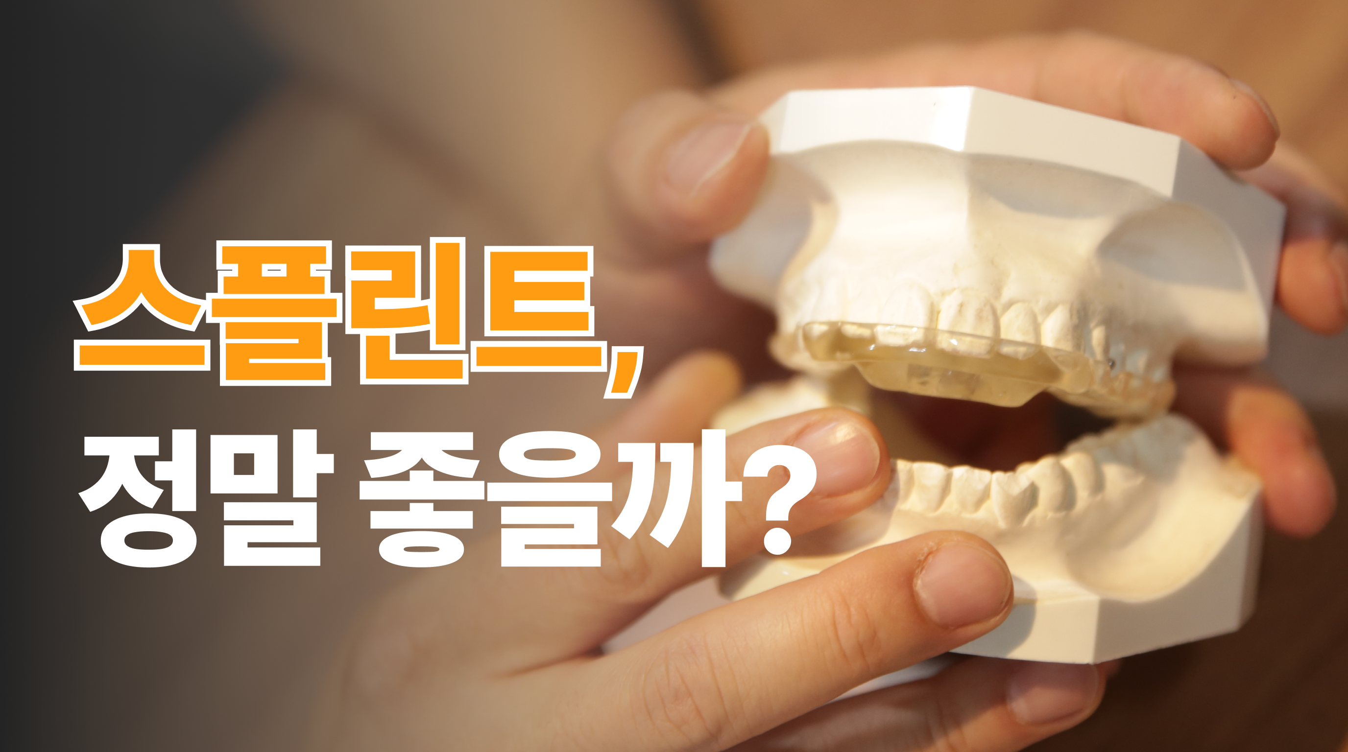 성남 스플린트 가격 대비 효과 좋을까?